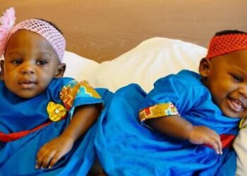 Tek yumurta ikizleri ve yapışık ikizler evrimi reddediyor!